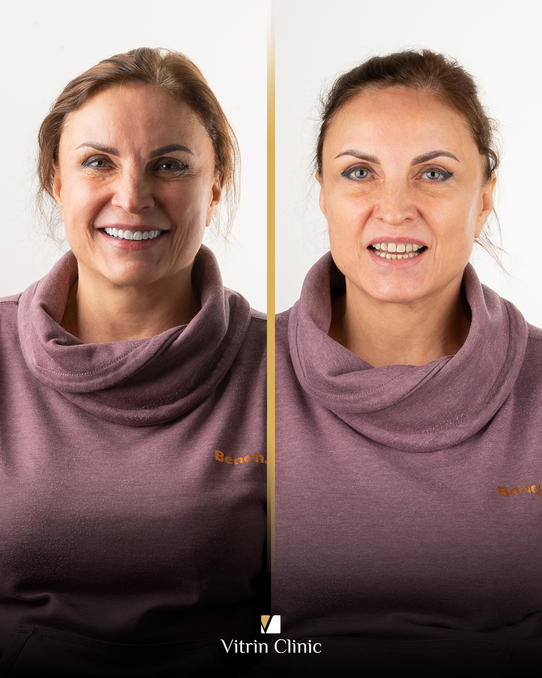 Jelena b&f